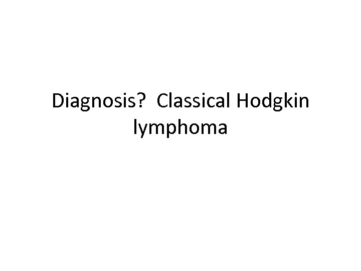 Diagnosis? Classical Hodgkin lymphoma 