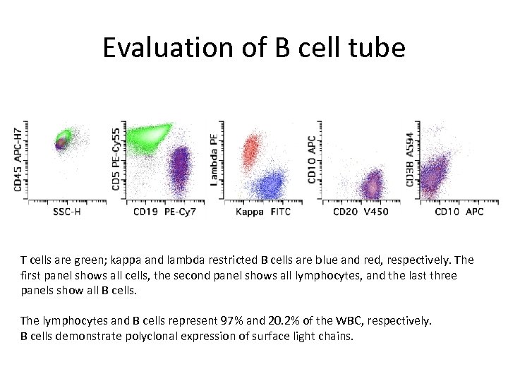 Evaluation of B cell tube T cells are green; kappa and lambda restricted B