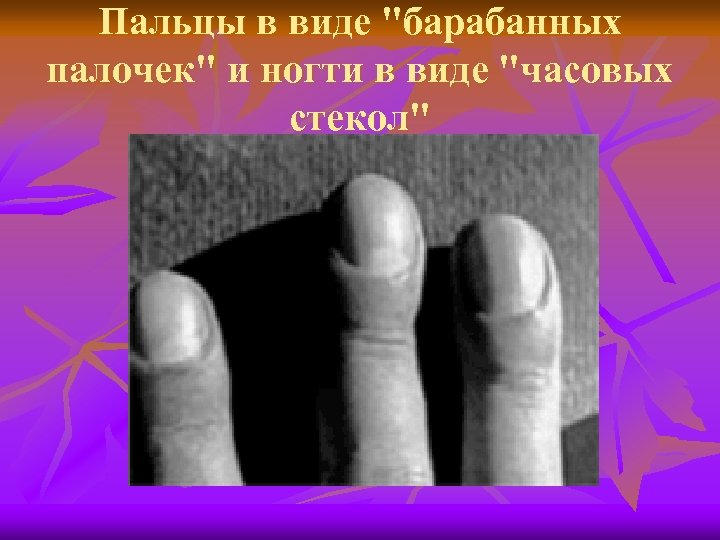 Пальцы в виде 