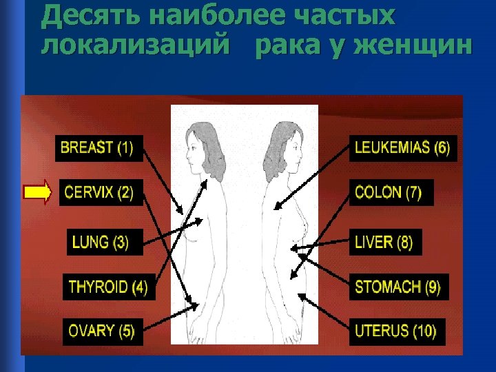 Десять наиболее частых локализаций рака у женщин 
