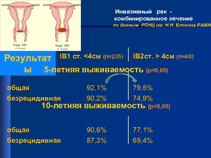  Инвазивный рак - комбинированное лечение по данным РОНЦ им. Н. Н. Блохина РАМН