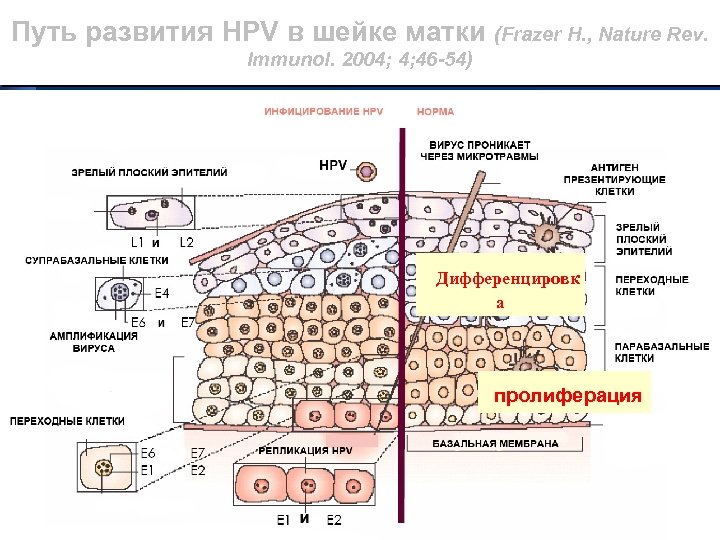 Путь развития HPV в шейке матки (Frazer H. , Nature Rev. Immunol. 2004; 4;