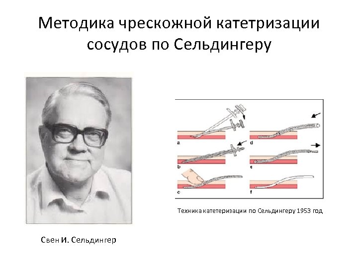 Схема по сельдингеру рентген