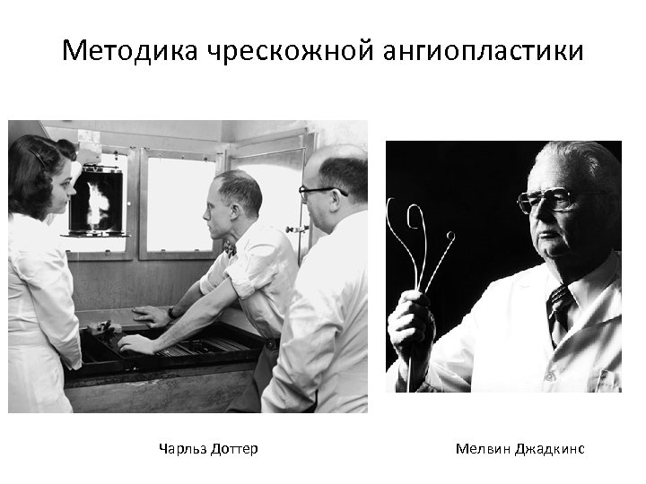 Методика чрескожной ангиопластики Чарльз Доттер Мелвин Джадкинс 