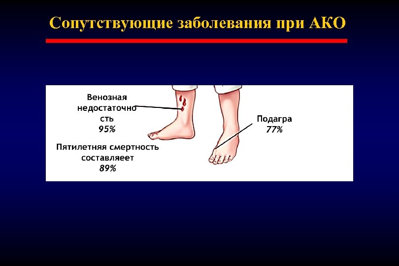 Сопутствующие заболевания при АКО 