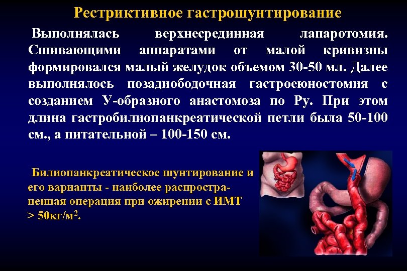 Рестриктивное гастрошунтирование Выполнялась верхнесрединная лапаротомия. Сшивающими аппаратами от малой кривизны формировался малый желудок объемом