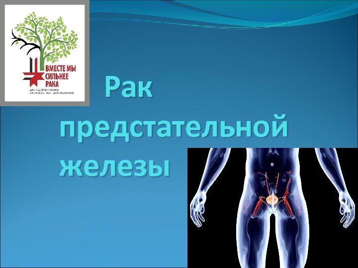 Рак предстательной железы 