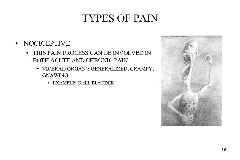 TYPES OF PAIN • NOCICEPTIVE • THIS PAIN PROCESS CAN BE INVOLVED IN BOTH