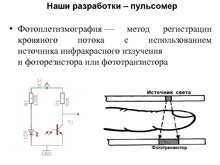 Принципиальная схема фотоплетизмографа