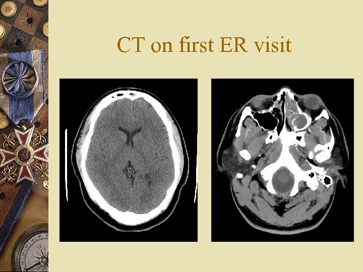 CT on first ER visit 