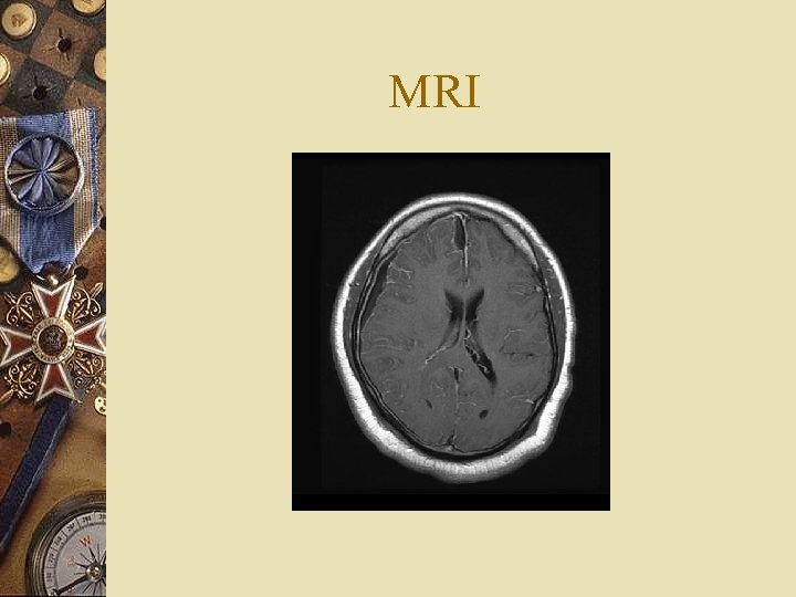 MRI 