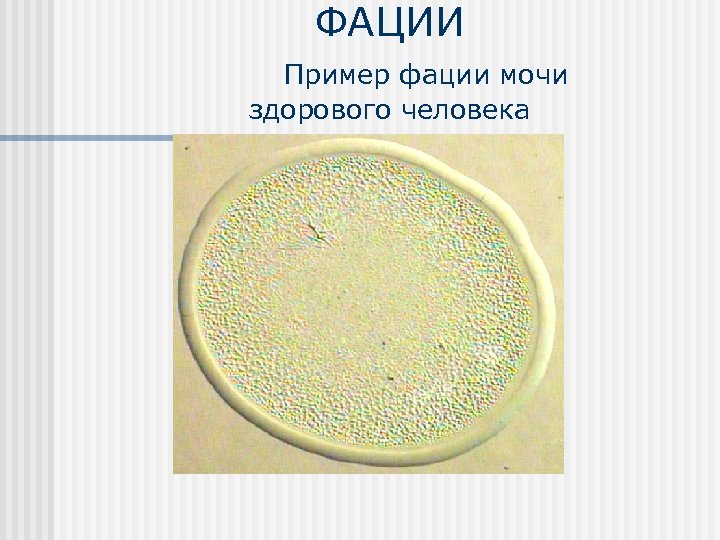 ФАЦИИ Пример фации мочи здорового человека 