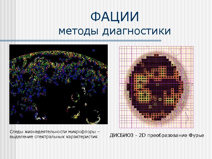 ФАЦИИ методы диагностики Следы жизнедеятельности микрофлоры – выделение спектральных характеристик ДИСБИОЗ - 2 D