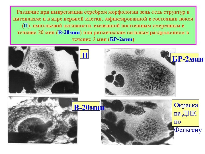 Различие при импрегнации серебром морфологии золь-гель структур в цитоплазме и в ядре нервной клетки,