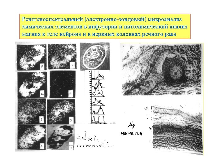 Рентгеноспектральный (электронно-зондовый) микроанализ химических элементов в инфузории и цитохимический анализ магния в теле нейрона