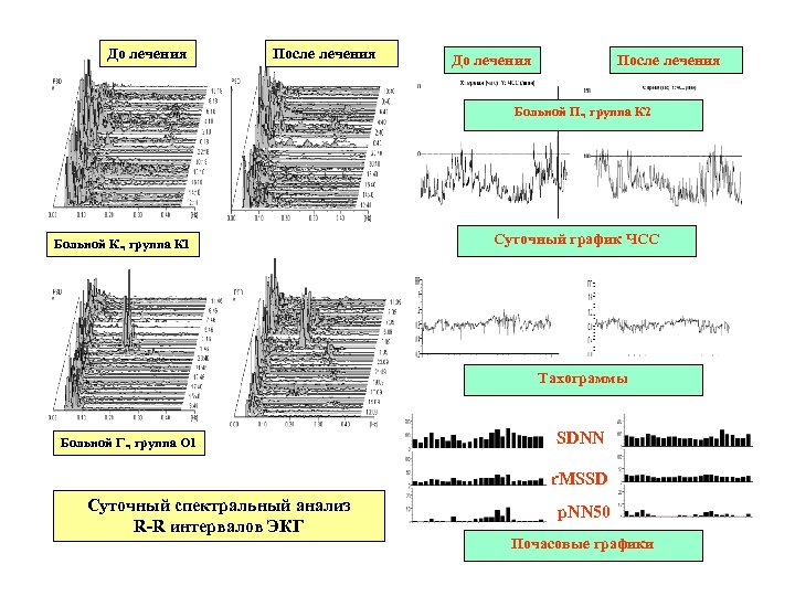 До лечения После лечения Больной П. , группа К 2 Больной К. , группа