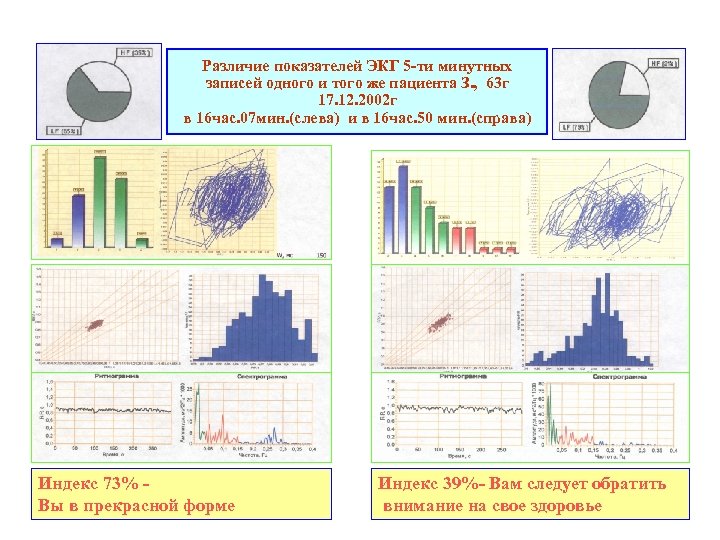 Различие показателей ЭКГ 5 -ти минутных записей одного и того же пациента З. ,