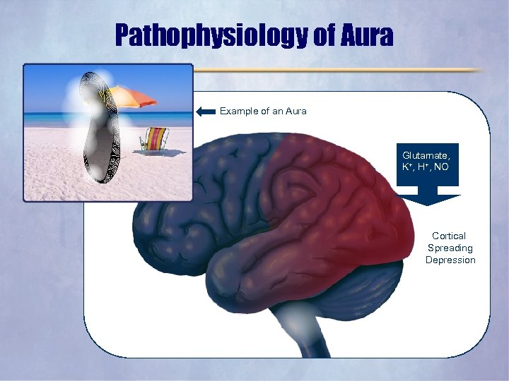 Pathophysiology of Aura Example of an Aura Glutamate, K+, H+, NO Cortical Spreading Depression