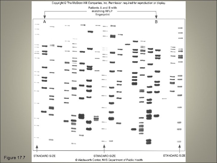 Figure 17. 7 