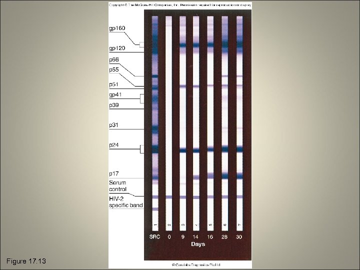 Figure 17. 13 