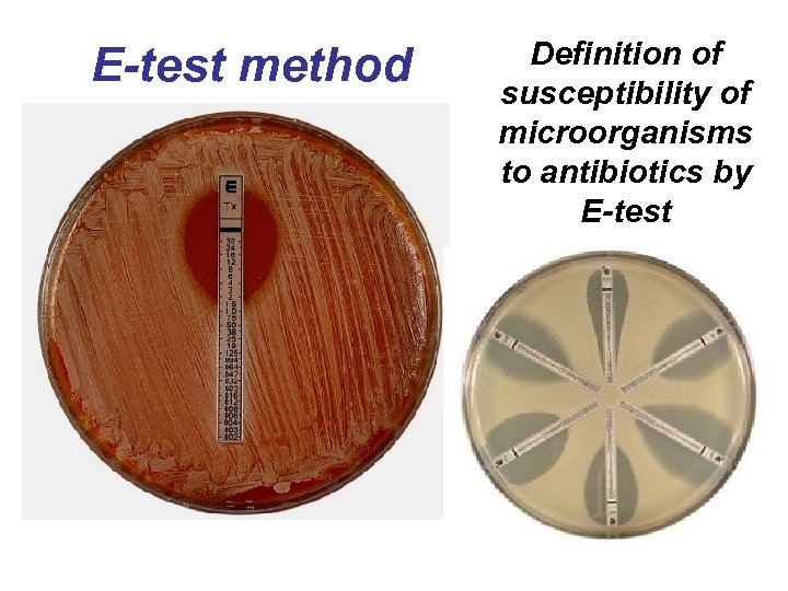 E-test method Definition of susceptibility of microorganisms to antibiotics by E-test 