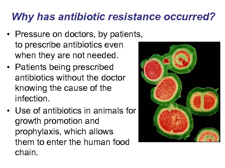 Why has antibiotic resistance occurred? • Pressure on doctors, by patients, to prescribe antibiotics