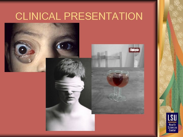 CLINICAL PRESENTATION 