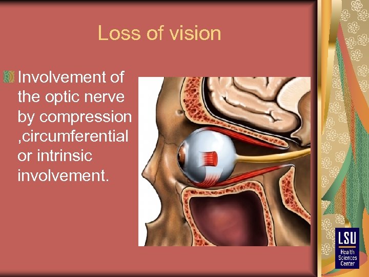 Loss of vision Involvement of the optic nerve by compression , circumferential or intrinsic