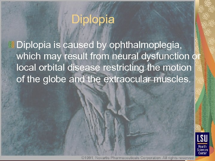 Diplopia is caused by ophthalmoplegia, which may result from neural dysfunction or local orbital