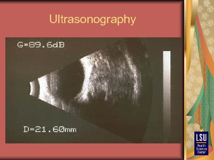 Ultrasonography 