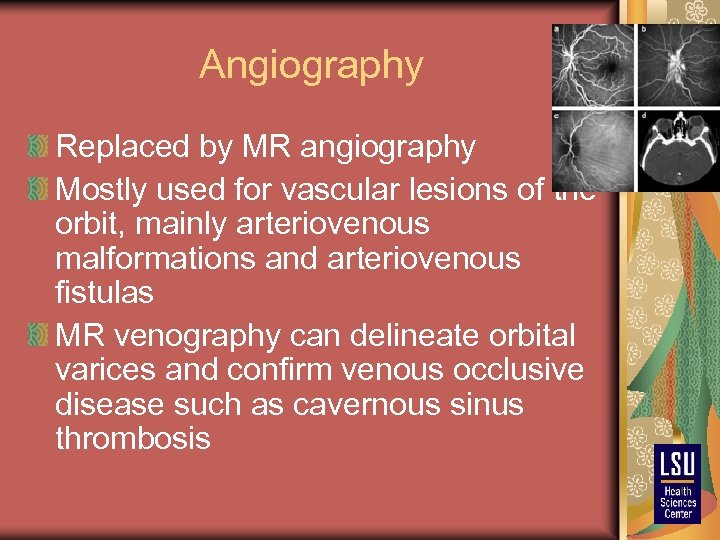 Angiography Replaced by MR angiography Mostly used for vascular lesions of the orbit, mainly