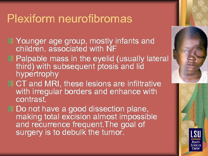 Plexiform neurofibromas Younger age group, mostly infants and children. associated with NF Palpable mass