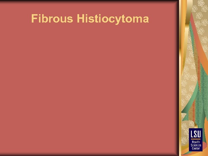 Fibrous Histiocytoma 