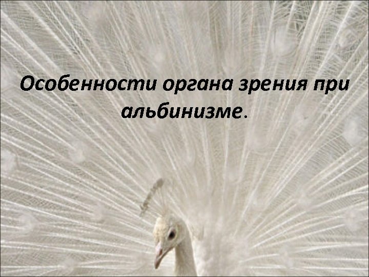 Особенности органа зрения при альбинизме. 