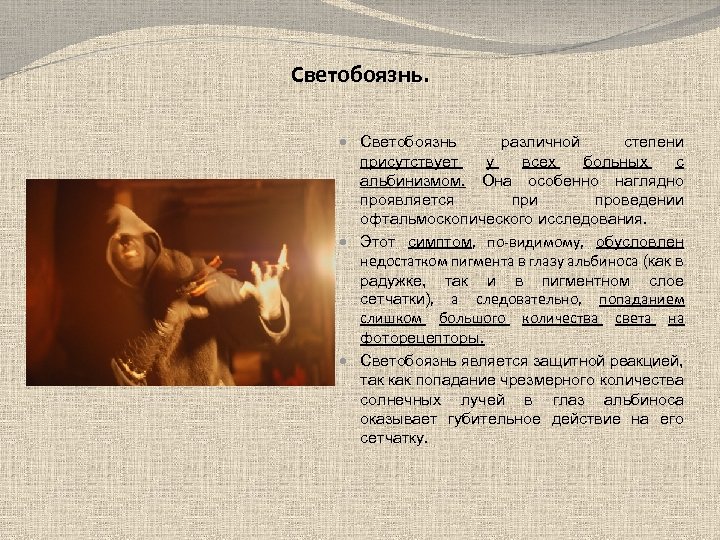 Светобоязнь. Светобоязнь различной степени присутствует у всех больных с альбинизмом. Она особенно наглядно проявляется