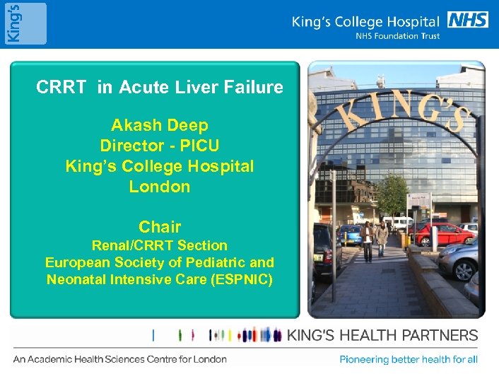 CRRT in Acute Liver Failure Akash Deep Director - PICU King’s College Hospital London