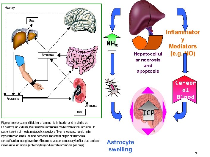 NH 3 Hepatocellul ar necrosis and apoptosis Inflammator y Mediators (e. g. NO) Cerebr