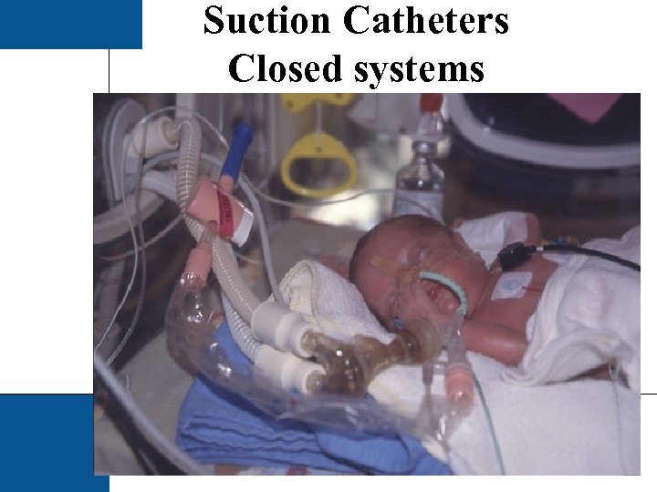 Suction Catheters Closed systems 