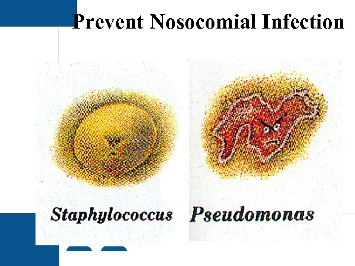 Prevent Nosocomial Infection 