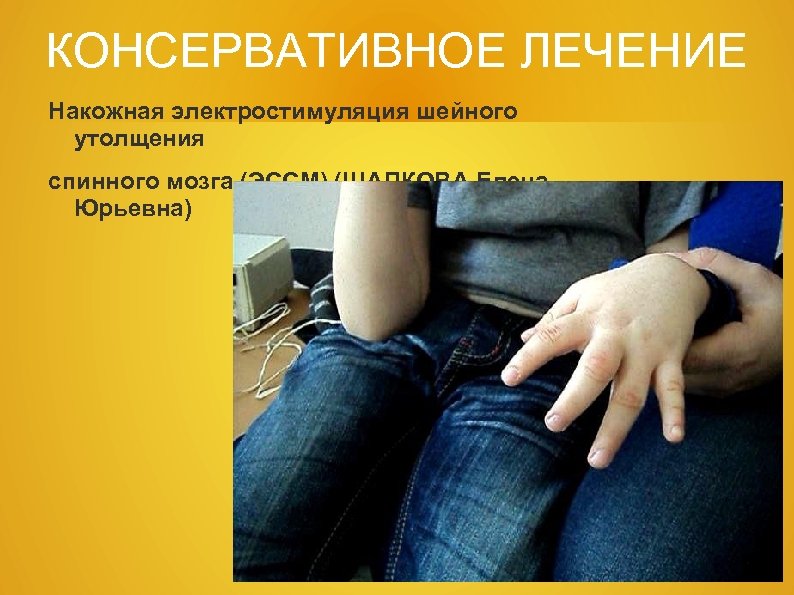 КОНСЕРВАТИВНОЕ ЛЕЧЕНИЕ Накожная электростимуляция шейного утолщения спинного мозга (ЭССМ) (ШАПКОВА Елена Юрьевна) 