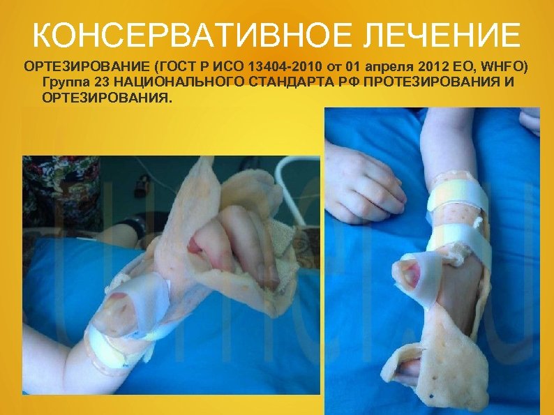 КОНСЕРВАТИВНОЕ ЛЕЧЕНИЕ ОРТЕЗИРОВАНИЕ (ГОСТ Р ИСО 13404 -2010 от 01 апреля 2012 EO, WHFO)