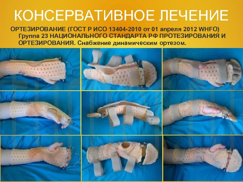 КОНСЕРВАТИВНОЕ ЛЕЧЕНИЕ ОРТЕЗИРОВАНИЕ (ГОСТ Р ИСО 13404 -2010 от 01 апреля 2012 WHFO) Группа