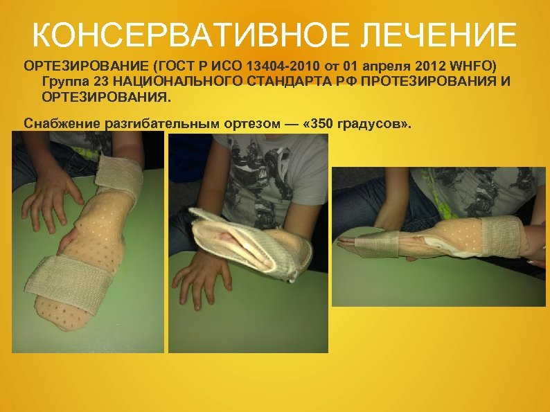 КОНСЕРВАТИВНОЕ ЛЕЧЕНИЕ ОРТЕЗИРОВАНИЕ (ГОСТ Р ИСО 13404 -2010 от 01 апреля 2012 WHFO) Группа