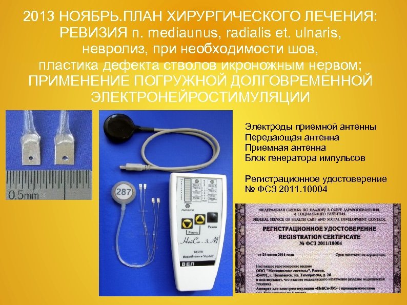 2013 НОЯБРЬ. ПЛАН ХИРУРГИЧЕСКОГО ЛЕЧЕНИЯ: РЕВИЗИЯ n. mediaunus, radialis et. ulnaris, невролиз, при необходимости