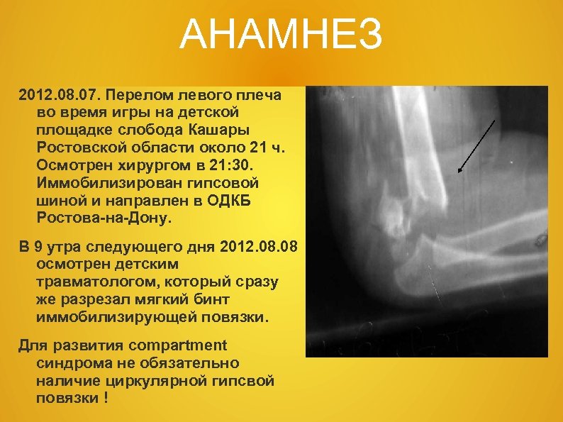 АНАМНЕЗ 2012. 08. 07. Перелом левого плеча во время игры на детской площадке слобода
