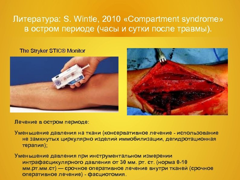 Литература: S. Wintle, 2010 «Сompartment syndrome» в остром периоде (часы и сутки после травмы).