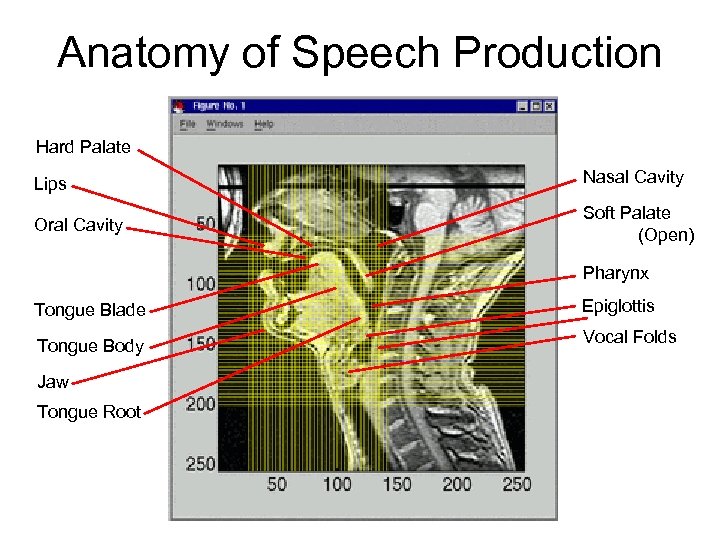 Anatomy of Speech Production Hard Palate Lips Nasal Cavity Oral Cavity Soft Palate (Open)