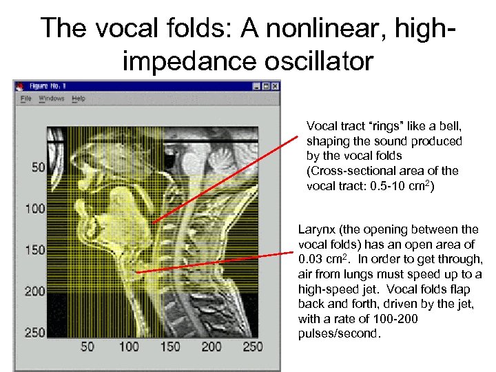 The vocal folds: A nonlinear, highimpedance oscillator Vocal tract “rings” like a bell, shaping