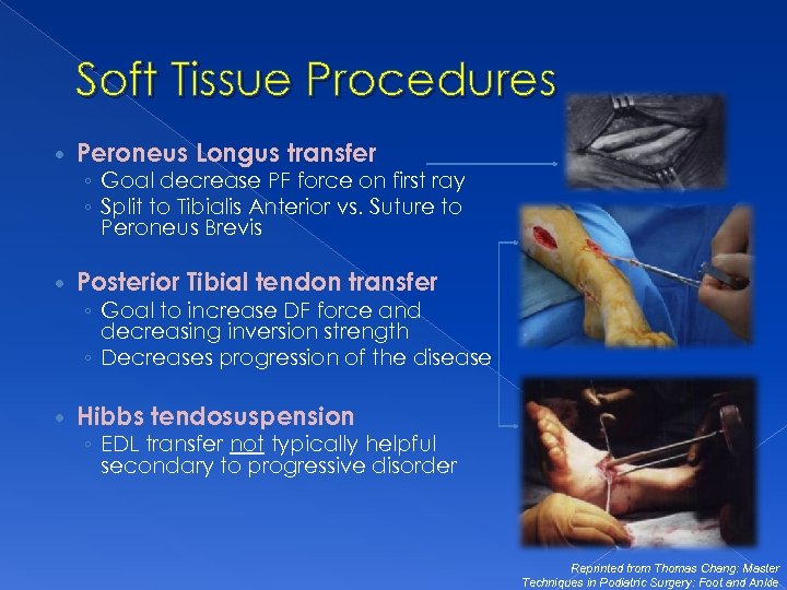 Soft Tissue Procedures Peroneus Longus transfer ◦ Goal decrease PF force on first ray