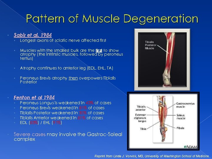 Pattern of Muscle Degeneration • Sabir et al. 1984 • • Muscles with the